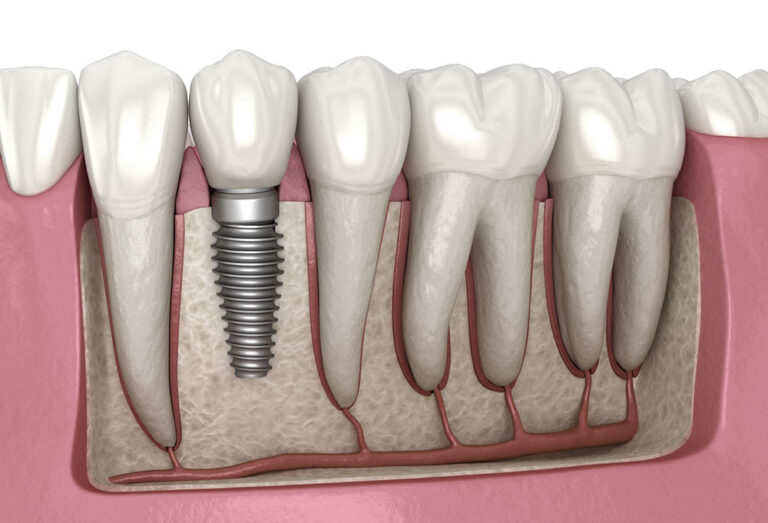 Asistente Dental Salario En Miami