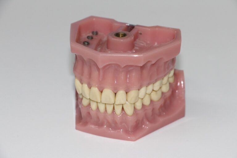 Cursos De Protesis Dental En Miami